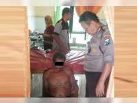 Diduga Alami Gangguan Jiwa, Seorang Warga Dander Aniaya Ibu Kandung, Ponakan dan Iparnya