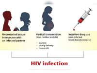 Penyebab Penularan HIV/ Aids di Bojonegoro Didominasi Hubungan Seksual