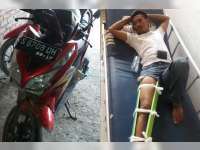 Kurang Konsentrasi, Vario Sruduk Truk di Margomulyo, Pengendara Patah Kaki