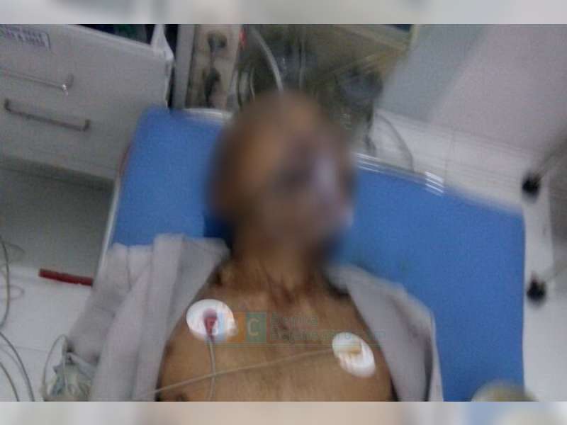Pengayuh Sepeda Pancal Yang Ditabrak Vixion di Baureno, Akhirnya Meninggal Dunia