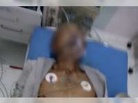 Pengayuh Sepeda Pancal Yang Ditabrak Vixion di Baureno, Akhirnya Meninggal Dunia