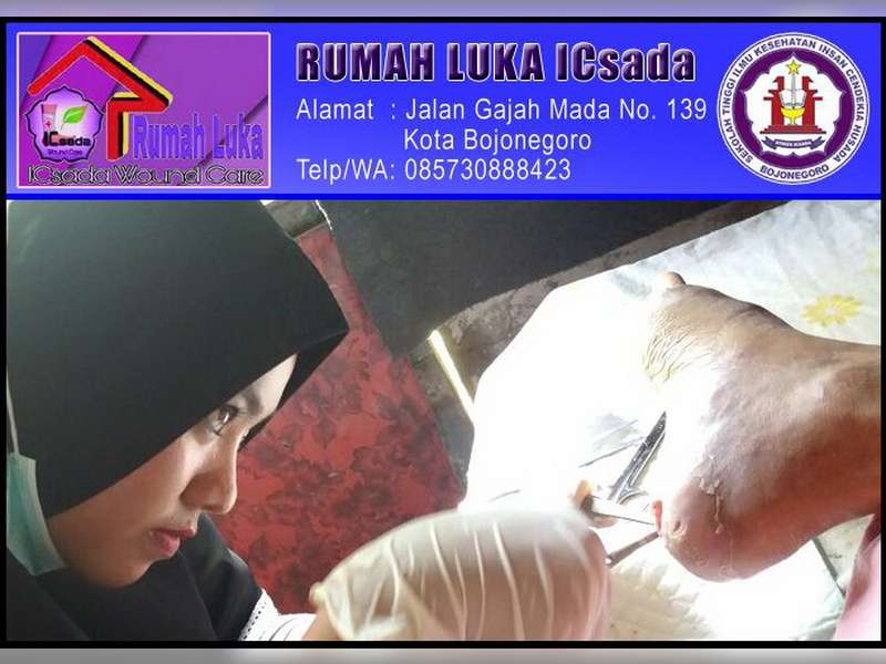 Ayo...! ke Rumah Luka ICsada