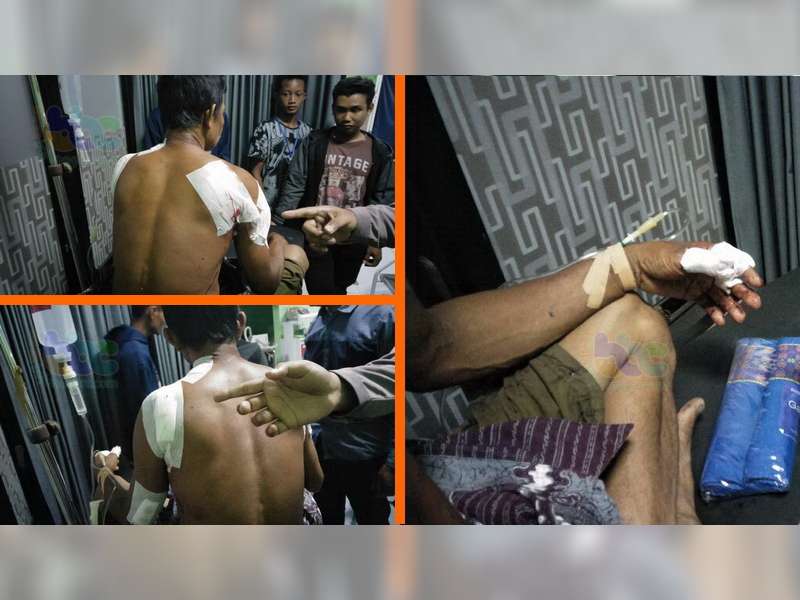Korban Penganiayaan di Kedungadem Alami Luka Bacok di Beberapa Bagian Tubuh