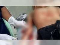 Seorang Remaja di Bojonegoro Jadi Korban Pembacokan