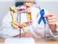 Waspada Early-Onset Cancer, Kasus Kanker pada Dewasa Muda Terus Melonjak di Berbagai Negara